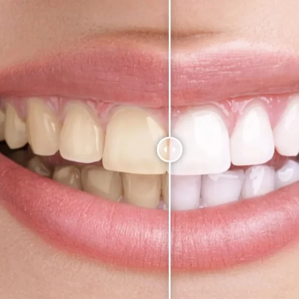 Before and After Image Comparison Plugin for WordPress